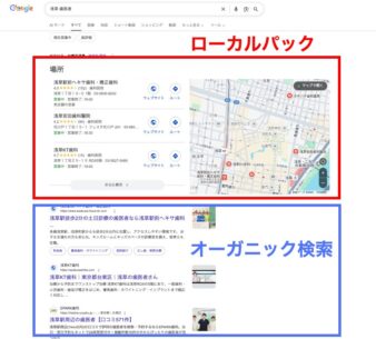 ローカルパック